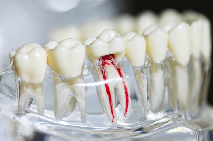 Root canal treatment Haripriya Multispeciality Dental Clinic, Dr. Uma Sundari Popuri